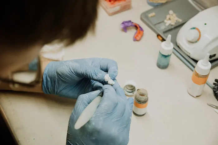 Dental lab technician carefully hand-crafting a porcelain prosthetic restoration — in-house laboratory work producing crowns, bridges and veneers to international quality standards at Antalya clinics