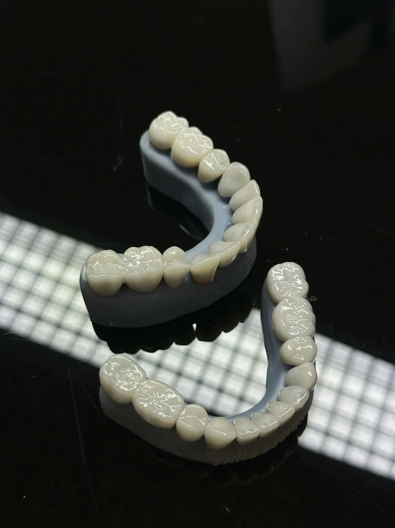 Porcelain E-max veneer shells crafted in an Antalya dental laboratory — the same premium material used in top UK cosmetic practices